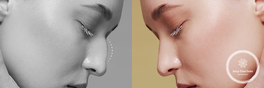 side-view-young-woman-before-after-rhinoplasty