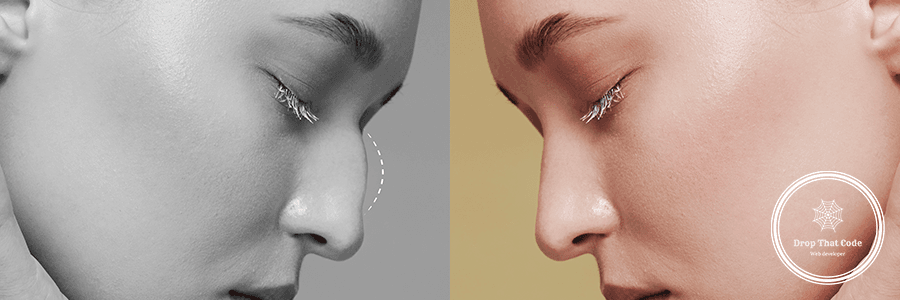 side-view-young-woman-before-after-rhinoplasty